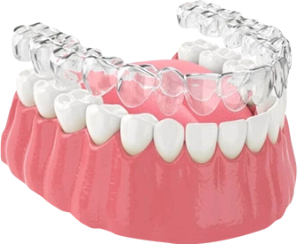 Niềng răng mắc cài