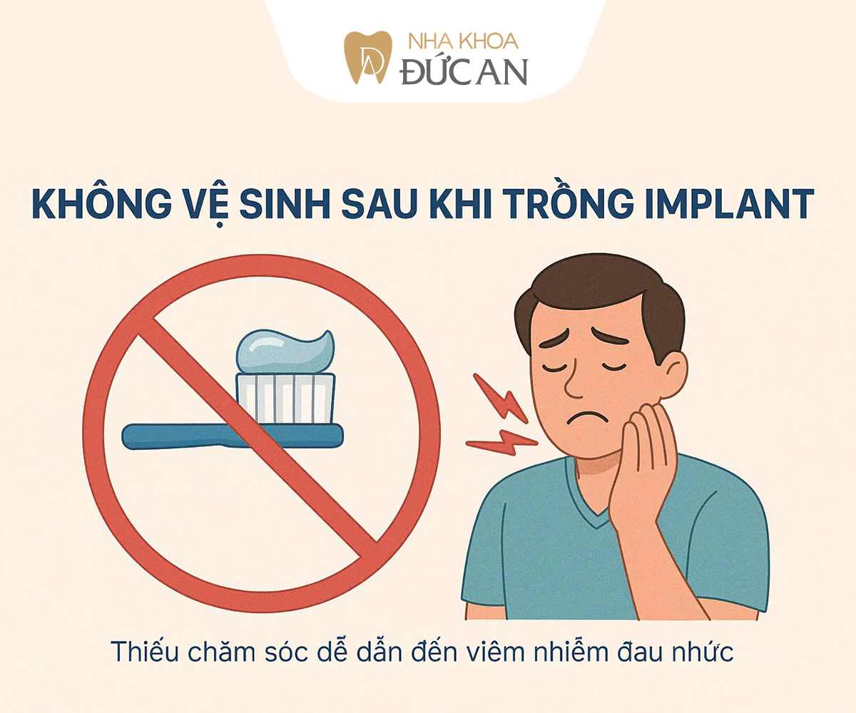 5 Sai lầm khi Trồng Implant Nha Trang khiến nhiều người gặp biến chứng