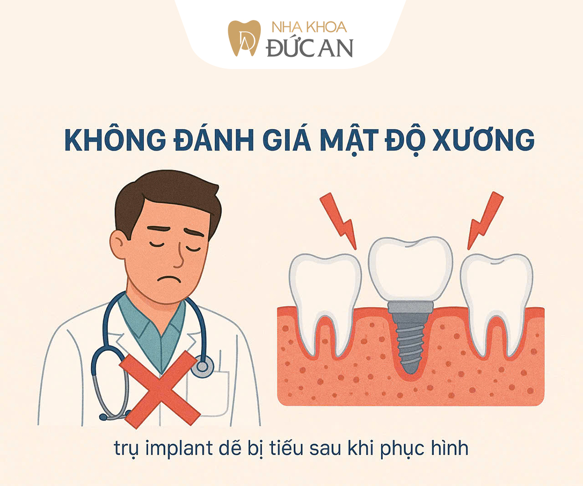 5 Sai lầm khi Trồng Implant Nha Trang khiến nhiều người gặp biến chứng