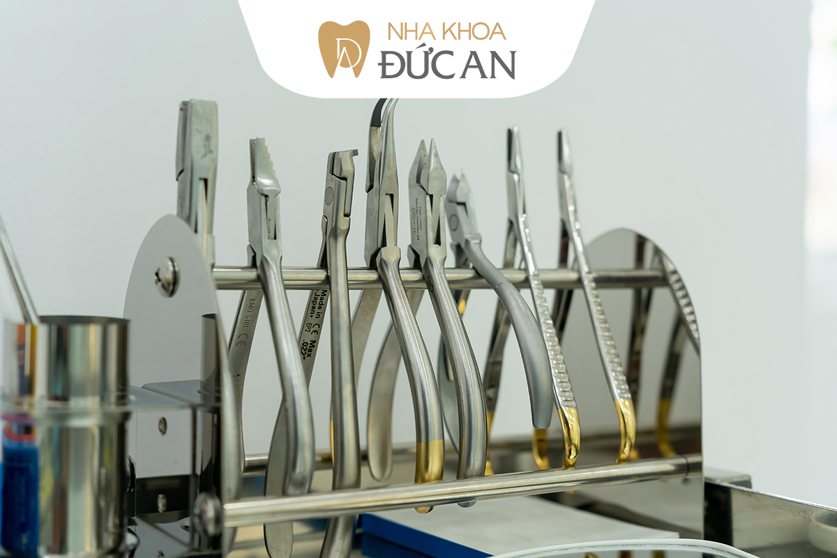Chi phí Niềng răng & Implant Nha Trang 2025 – Đắt hay rẻ? So sánh thực tế