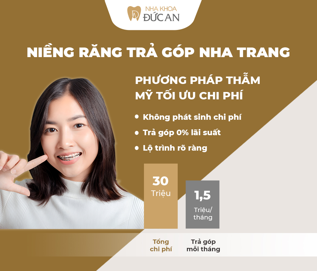 Niềng Răng Trả Góp Nha Trang – Không Còn Là Gánh Nặng Tài Chính