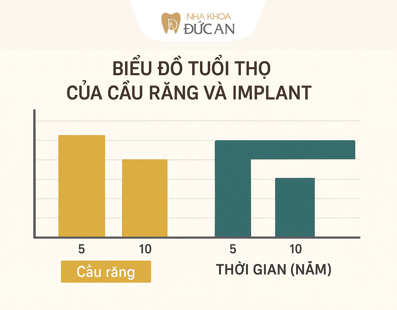 So sánh Cầu Răng và Implant – Giải pháp nào bền vững hơn?