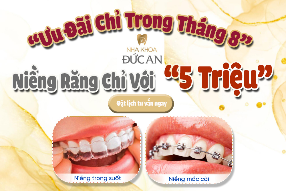 Ưu đãi tháng 8 niềng răng chỉ 5 triệu tại Nha Khoa Đức An Nha Trang