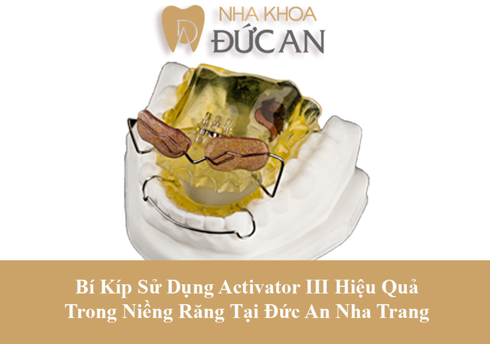 Activator 3 - Niềng Răng Đức An Nha Trang