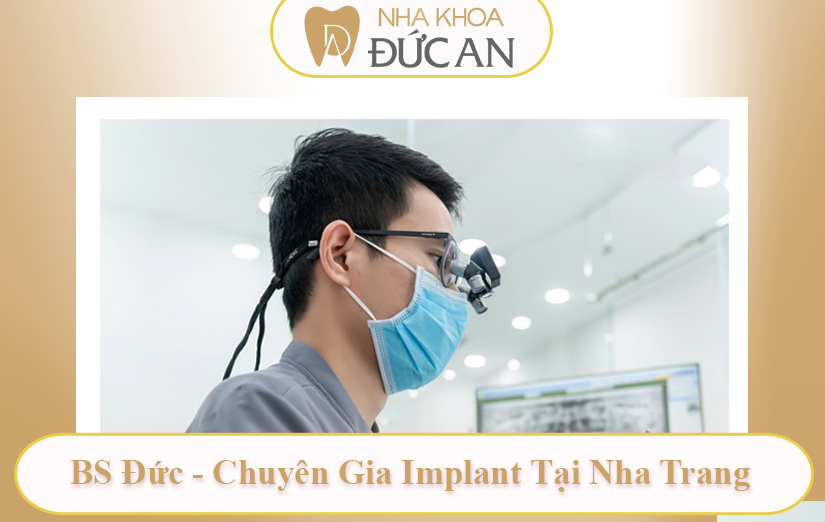 Review A-Z Kiến Thức Implant Chuyên Sâu Tại Nha Khoa Đức An Nha Trang