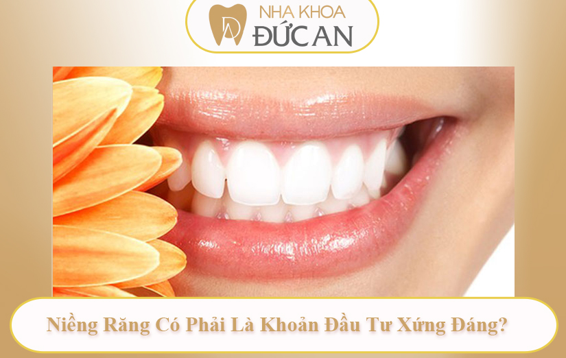 Chi Phí Niềng Răng Phụ Thuộc Vào Điều Gì? Giải Mã Từ A–Z Tại Nha Khoa Đức An Nha Trang