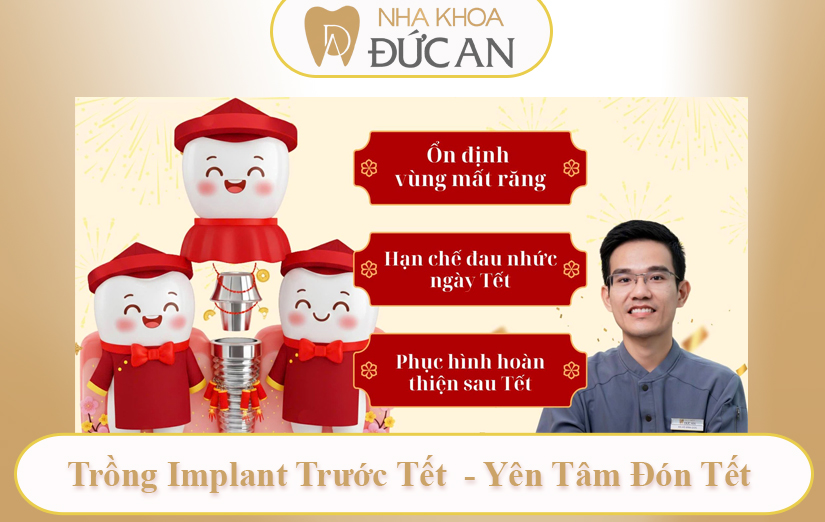 Trồng răng Implant trước Tết 2026 – chuẩn bị nền tảng ổn định tại Nha Khoa Đức An Nha Trang