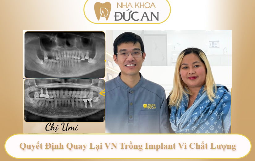 Du Lịch Khắp Năm Châu Nhưng Về Việt Nam Trồng Implant tại Nha Khoa Đức An Nha Trang