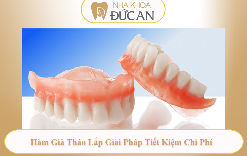 Top 5 Phương Pháp Trồng Răng Giả Cho Người Già Tốt Nhất Hiện Nay Tại Đức An Nha Trang | Implant Nha Trang