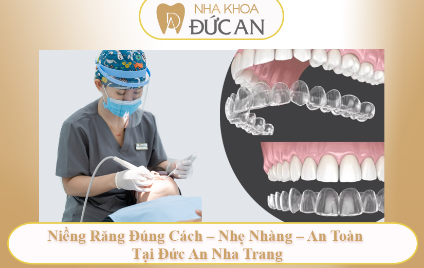 Niềng Răng Có Đau Không? Khi Nào Đau Nhất? Giải Đáp Từ Bác Sĩ Chuyên Sâu Nha Trang