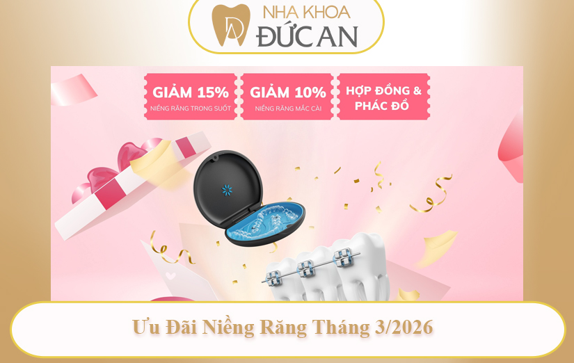 Ưu Đãi Nha Khoa Nha Trang Hấp Dẫn Cho Nàng 8/3 2026 Implant, Niềng Răng, Nhổ Răng Khôn