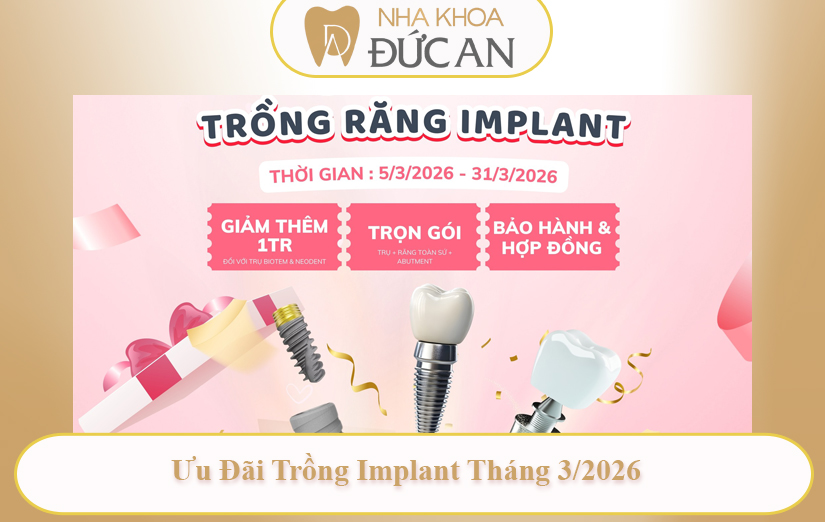 Ưu Đãi Nha Khoa Nha Trang Hấp Dẫn Cho Nàng 8/3 2026 Implant, Niềng Răng, Nhổ Răng Khôn
