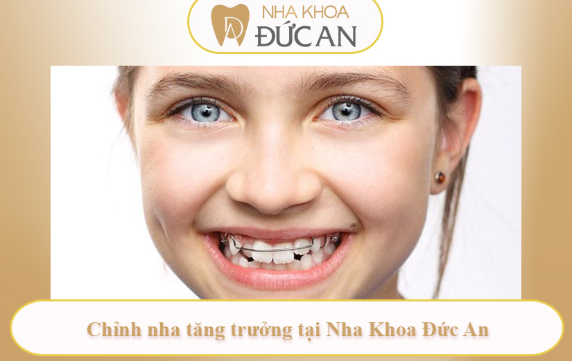 Chỉnh Nha Tăng Trưởng Cho Trẻ - Giai Đoạn Vàng Giúp Con Sở Hữu Nụ Cười Hoàn Hảo Tại Đức An Nha Trang
