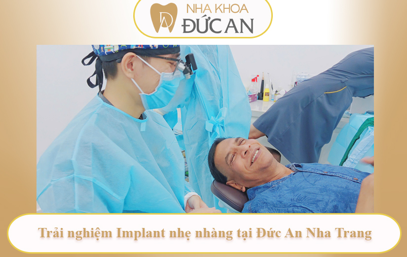 Hiểu Đúng Về Trồng Implant Nha Trang Để Không Còn Lo Lắng