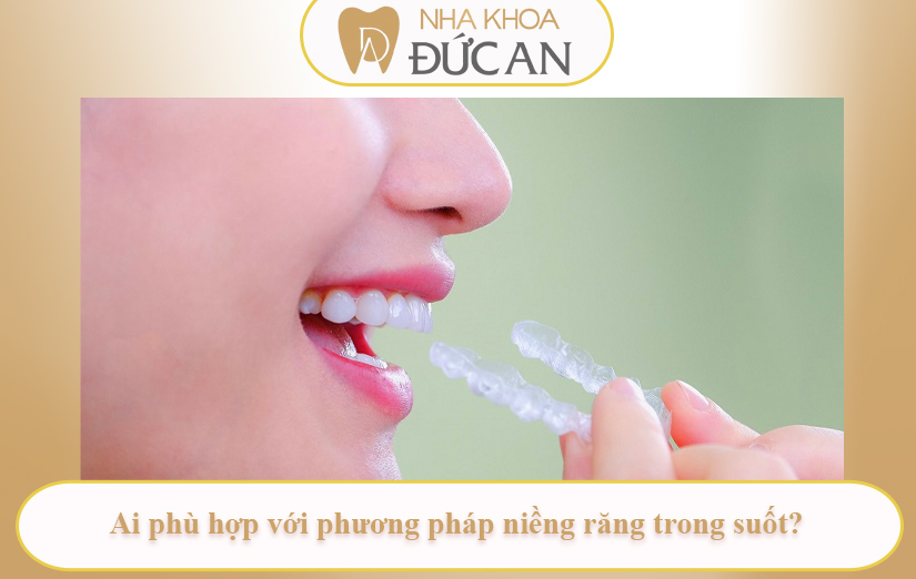 Quy Trình Niềng Răng Trong Suốt Từ A–Z Tại Nha Khoa Đức An Nha Trang