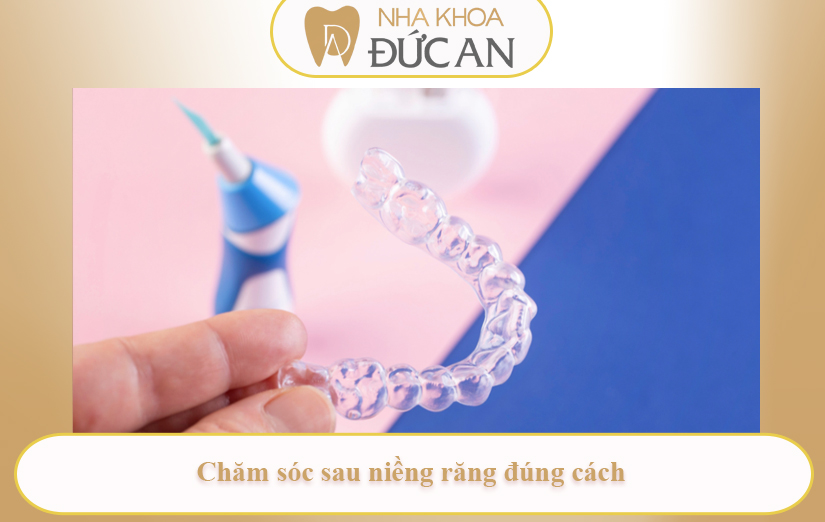 Quy Trình Niềng Răng Trong Suốt Từ A–Z Tại Nha Khoa Đức An Nha Trang