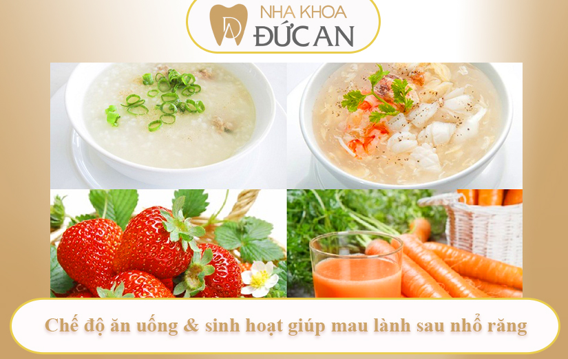 Mẹo giảm đau nhanh tại nhà an toàn từ chuyên gia Nha Khoa Đức An Nha Trang