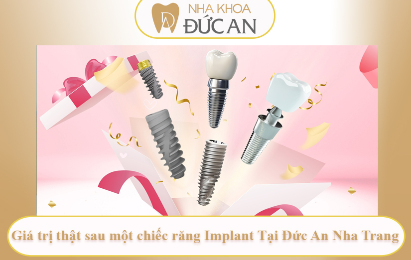 Từ Ninh Thuận ra Nha Trang trồng Implant – Vì một lựa chọn “trọn gói” đáng tin tại Nha Khoa Đức An