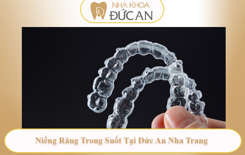 Quy Trình Niềng Răng Trong Suốt Từ A–Z Tại Nha Khoa Đức An Nha Trang