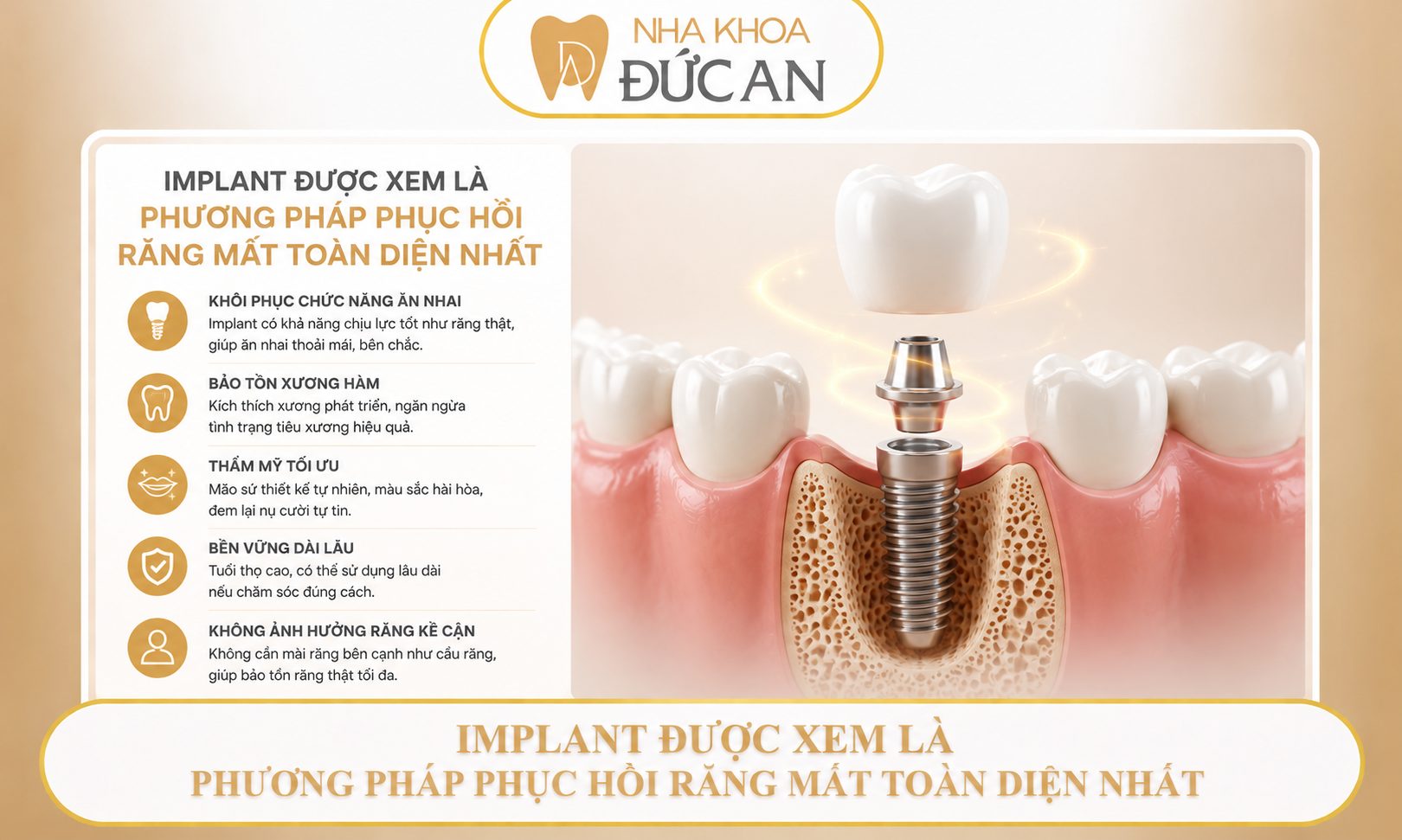 Đừng chủ quan khi mất 1 răng - Cảnh báo từ chuyên gia implant Nha Trang