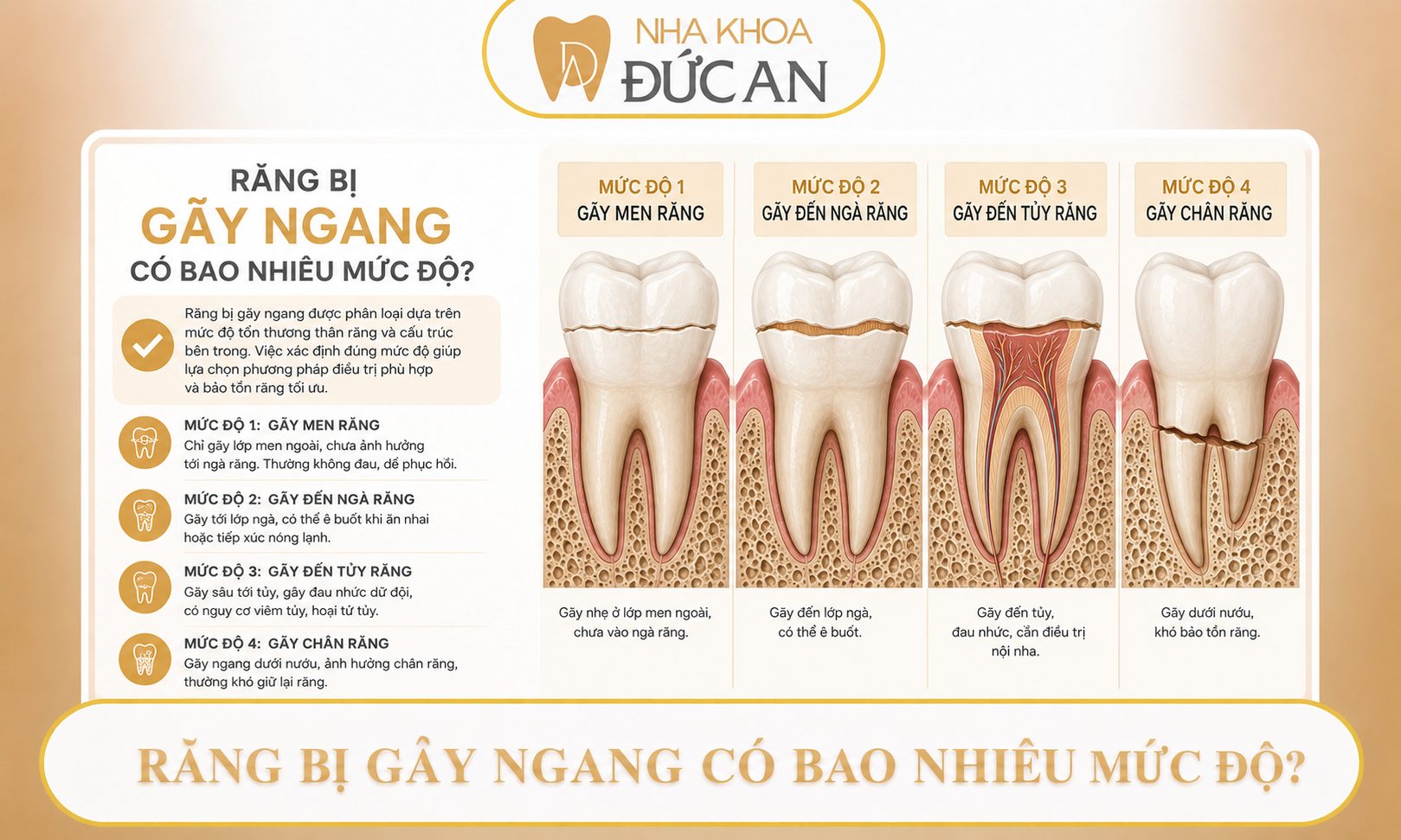 Răng bị gãy ngang phải làm sao? 5 giải pháp khắc phục hiệu quả tại Đức An Nha Trang
