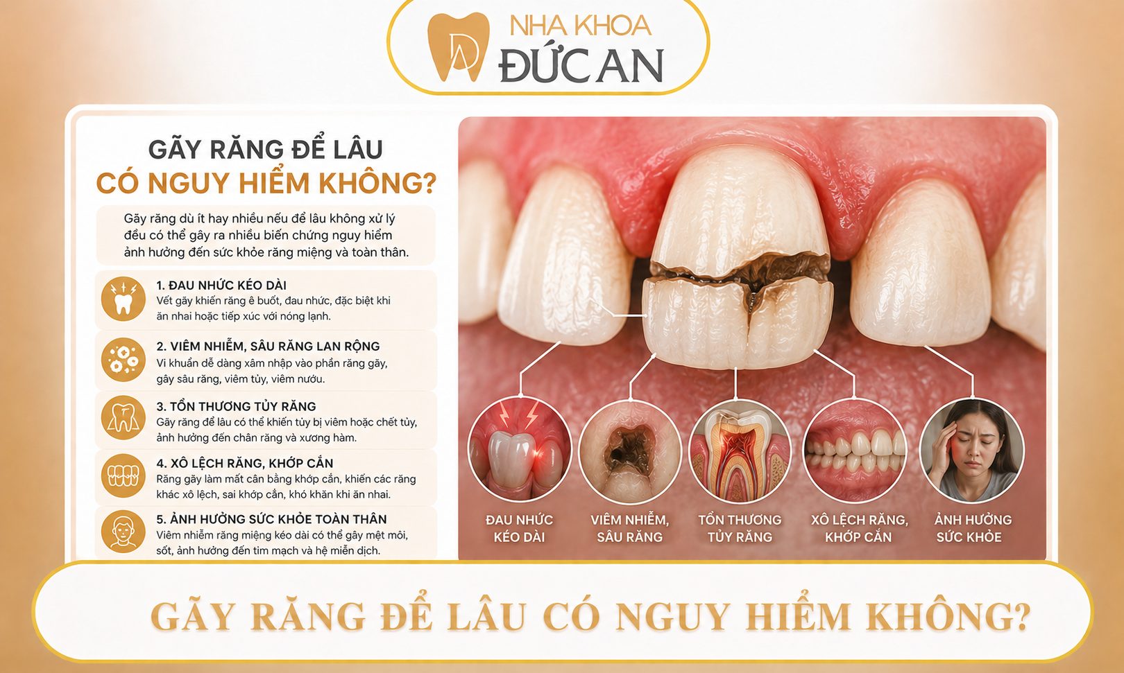 Răng bị gãy ngang phải làm sao? 5 giải pháp khắc phục hiệu quả tại Đức An Nha Trang