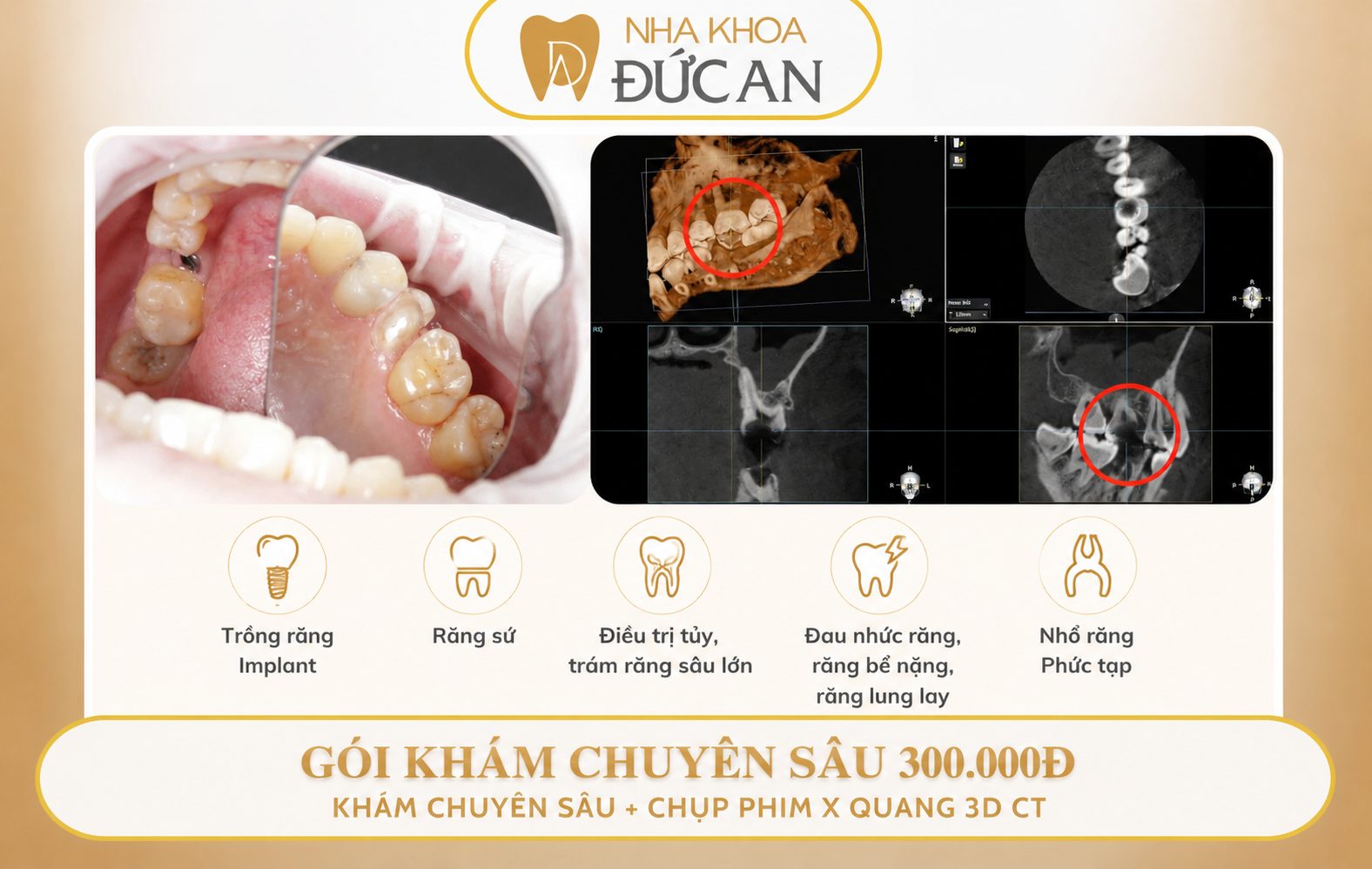 Các gói khám từ tổng quát đến chuyên sâu tại Nha Khoa Đức An Nha Trang
