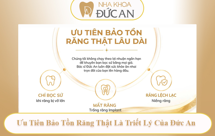 Vì sao Nha Khoa Đức An Nha Trang hạn chế làm răng sứ khi chưa cần thiết?