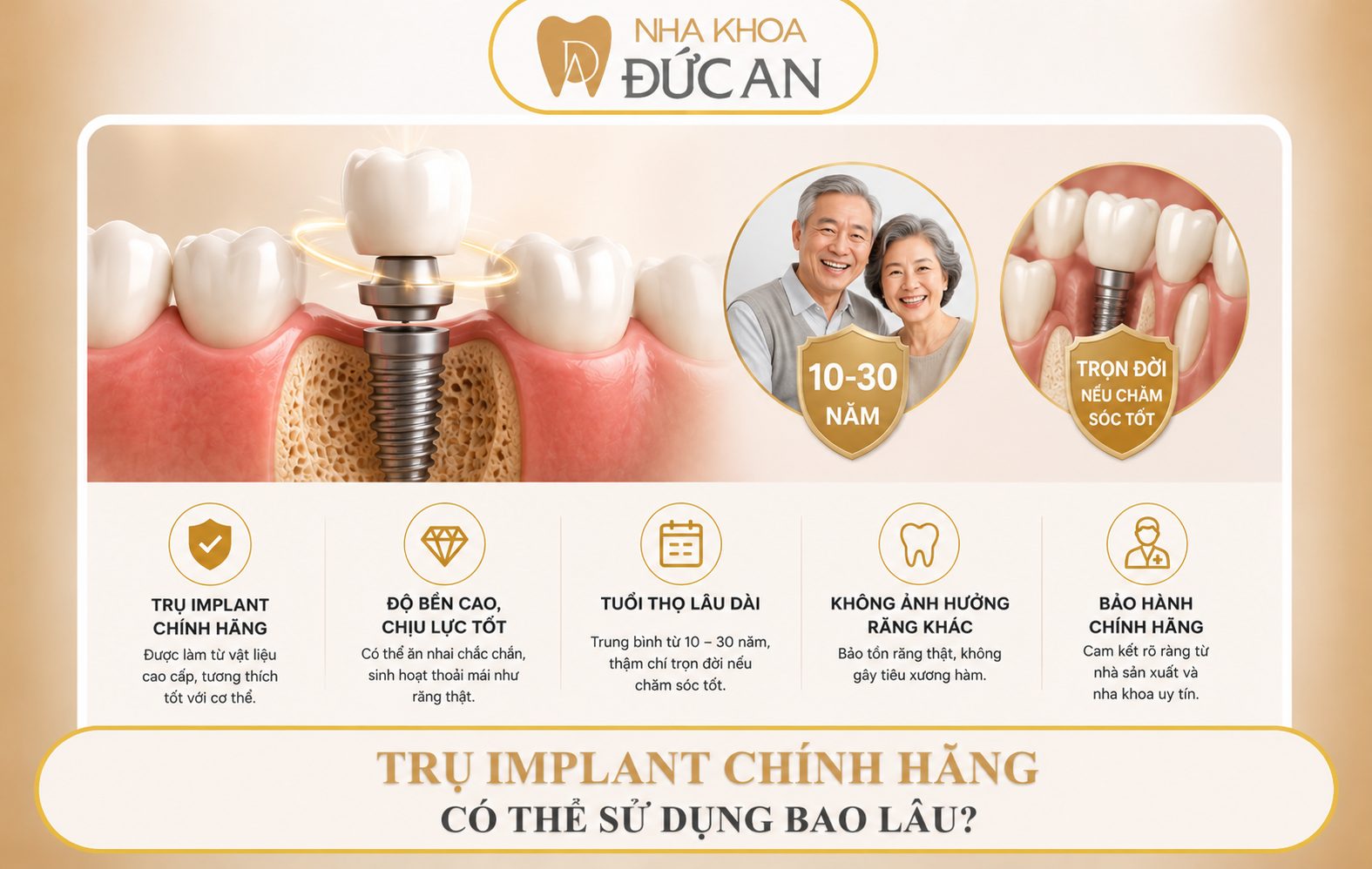 Bảo hành 5 năm là Implant sẽ hư? BS Implant Nha Trang giải đáp