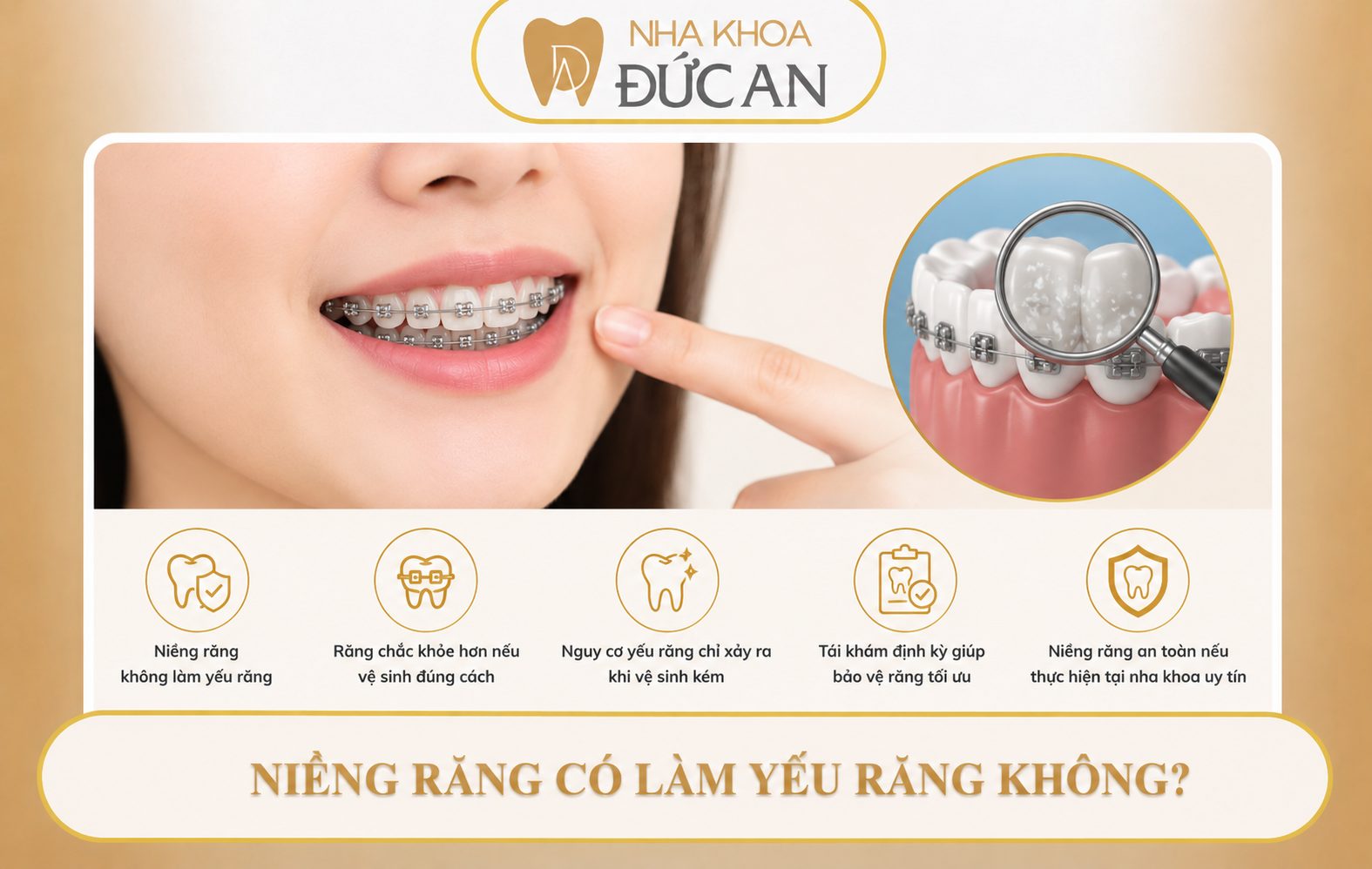 Niềng Răng Nha Trang Không Chỉ Để Đẹp – Mà Còn Để Bảo Vệ Sức Khỏe Răng Miệng Lâu Dài