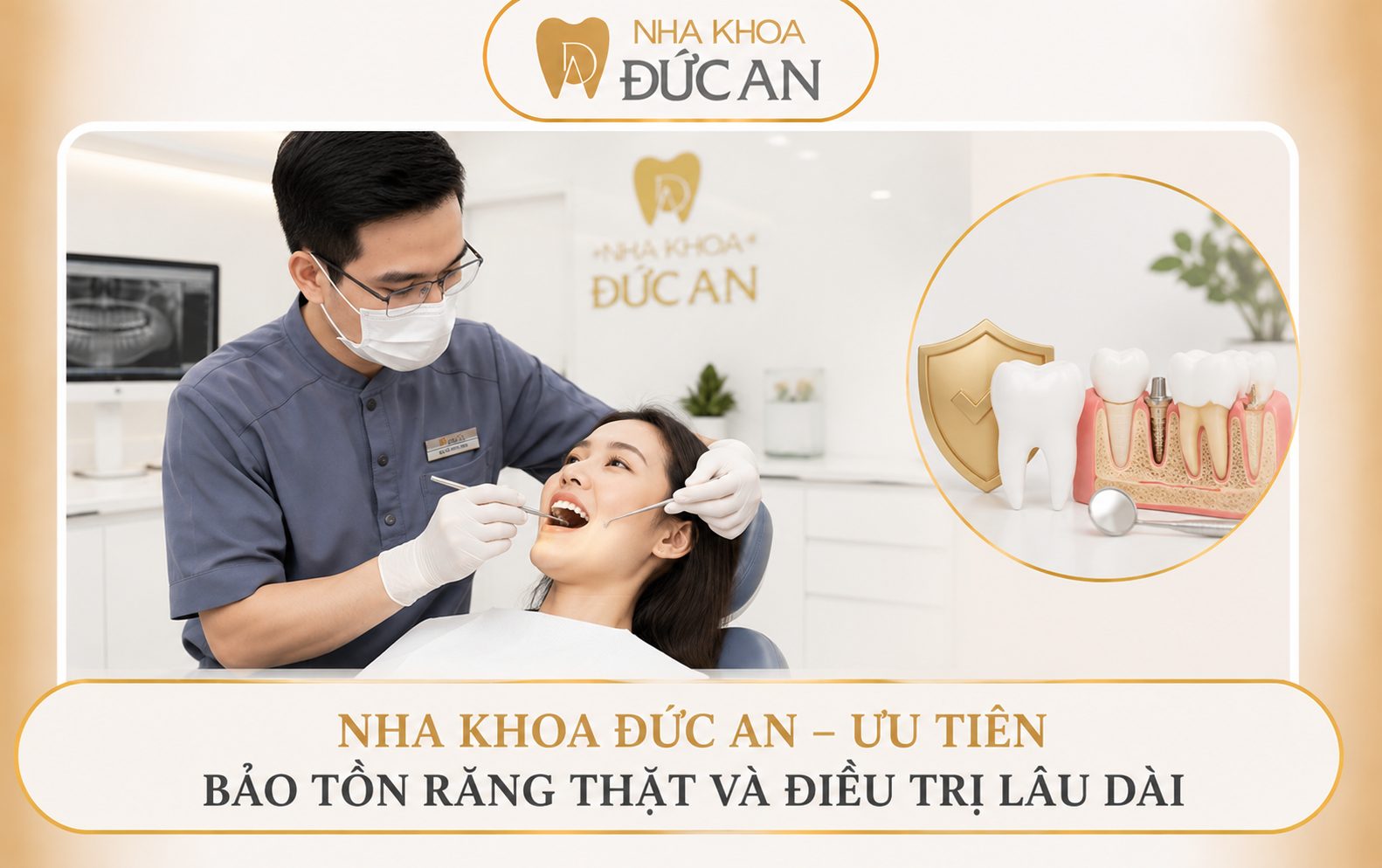 Bắc Cầu Răng - Góc Nhìn Chuyên Gia Implant Từ Nha Khoa Đức An Nha Trang