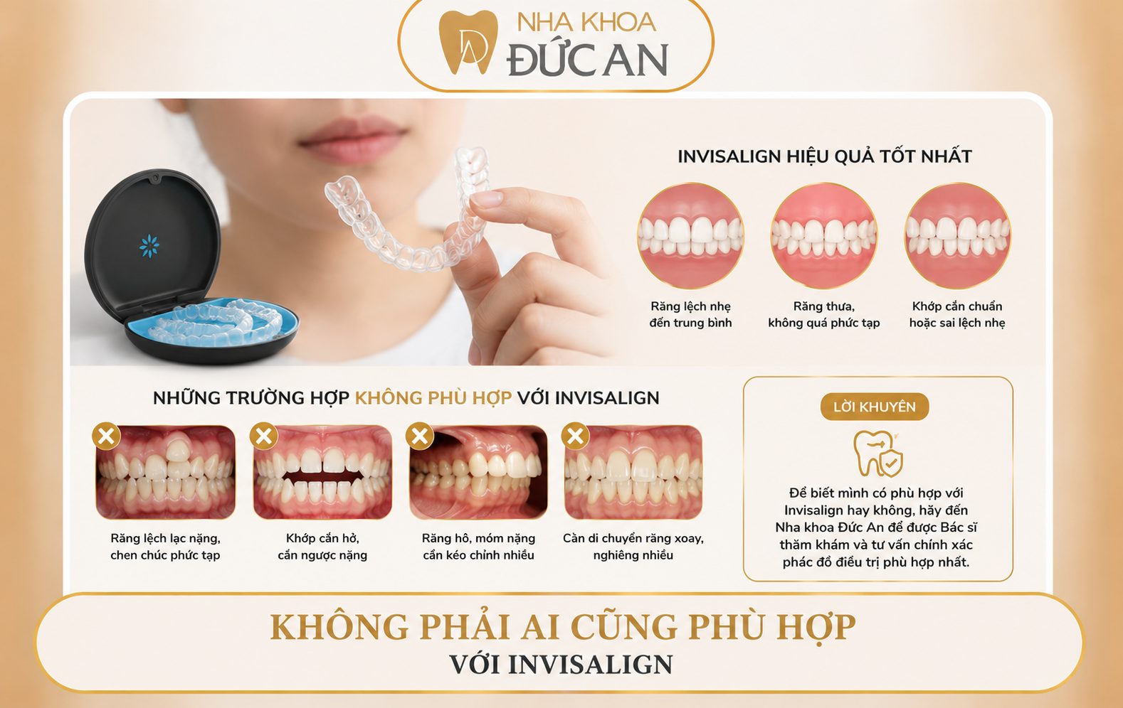 Invisalign Nha Trang – Niềng Răng Trong Suốt Để Đẹp Hơn & Sống Thoải Mái Hơn Mỗi Ngày