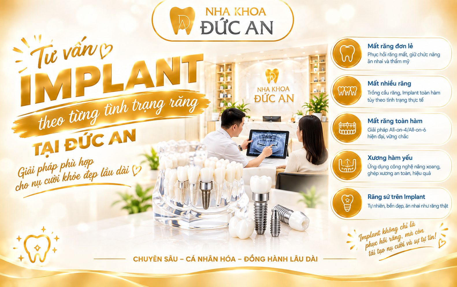 Tư vấn trồng Implant Nha khoa Đức An